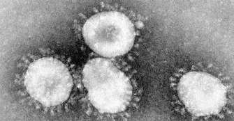 INS confirmÃ³ que no hay caso de coronavirus en Cali